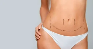 Cirurgia Plástica em Poços de Caldas - Cuidados no Pré-Operatório